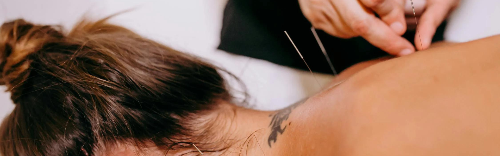 Acupuncture & herbs: natural solutions for stress