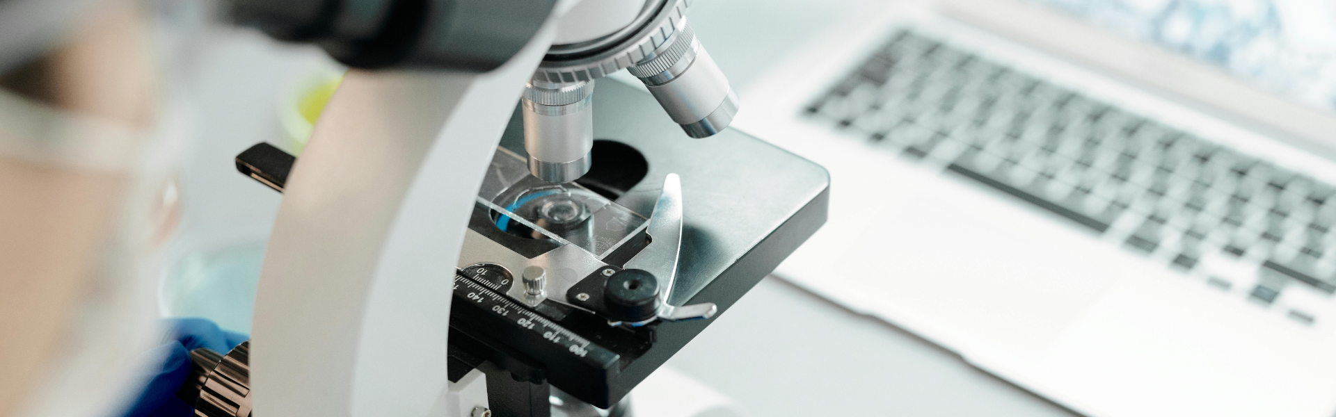 How metabolic testing takes the guesswork out of candida diagnosis